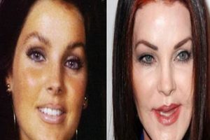 Celebrity Plastic Surgery Gone Wrong: Disasters & Fixes Safem Fabrication - Precision Engineering & Custom Manufacturing Solutions Celebrity Plastic Surgery Gone Wrong: Disasters & Fixes | Safem Fabrication - Precision Engineering & Custom Manufacturing Solutions