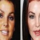 Celebrity Plastic Surgery Gone Wrong: Disasters & Fixes | Disaster Information Hub – Latest Natural Disaster News & Emergency Resources