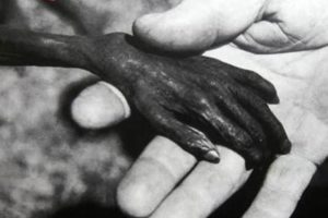 Worst Plastic Surgery Disasters: A Cautionary List Disaster Information Hub – Latest Natural Disaster News & Emergency Resources Worst Plastic Surgery Disasters: A Cautionary List | Disaster Information Hub – Latest Natural Disaster News & Emergency Resources