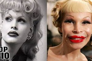 Plastic Surgery Disasters: Avoiding & Fixing Them Disaster Information Hub – Latest Natural Disaster News & Emergency Resources Plastic Surgery Disasters: Avoiding & Fixing Them | Disaster Information Hub – Latest Natural Disaster News & Emergency Resources