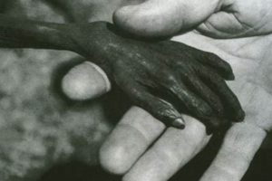 Dead Kennedys' Plastic Surgery Disasters: A Punk Critique Disaster Information Hub – Latest Natural Disaster News & Emergency Resources Dead Kennedys' Plastic Surgery Disasters: A Punk Critique | Disaster Information Hub – Latest Natural Disaster News & Emergency Resources