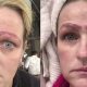 Microblading Gone Wrong: Avoid Disaster | Disaster Information Hub – Latest Natural Disaster News & Emergency Resources