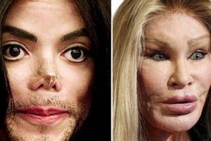Worst Celebrity Plastic Surgery Fails & Disasters | Disaster Information Hub – Latest Natural Disaster News & Emergency Resources