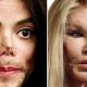 Worst Celebrity Plastic Surgery Fails & Disasters | Disaster Information Hub – Latest Natural Disaster News & Emergency Resources